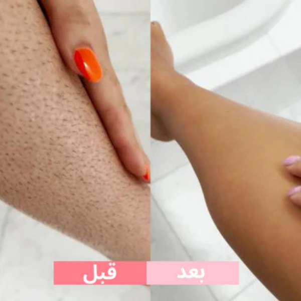 جهاز إزالة الشعر بالليزر المنزلي – نتائج احترافية في المنزل